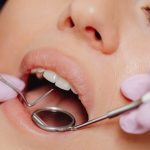 Post Tooth Replacement Care: Tips and Tricks